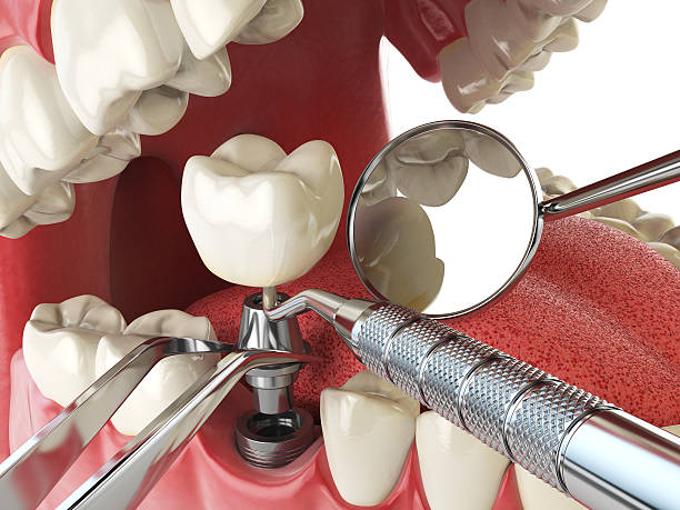 Best Urgent Care for Lost Fillings or Crowns in Sweeny, TX